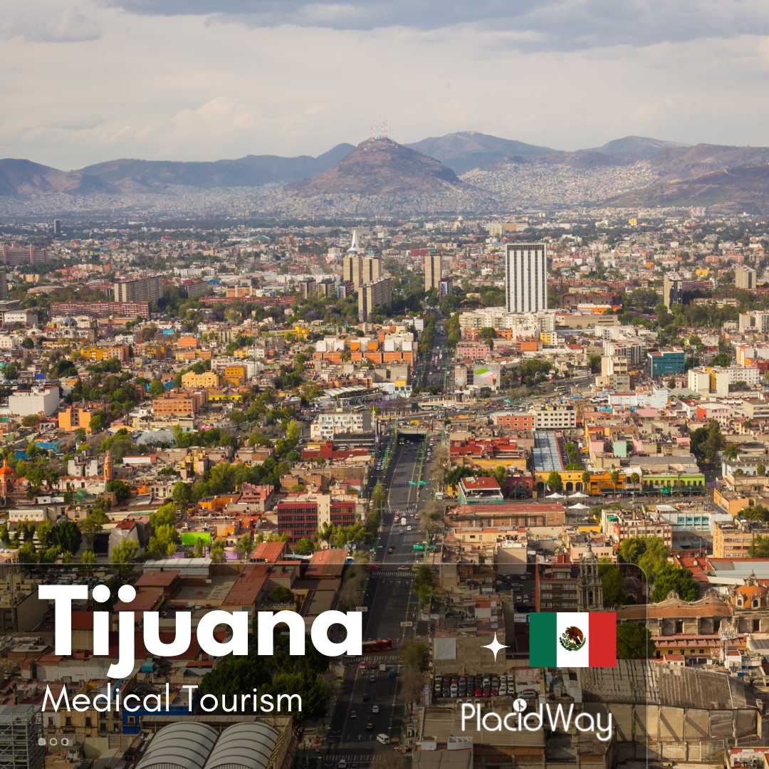 Tijuana Medical Tourism